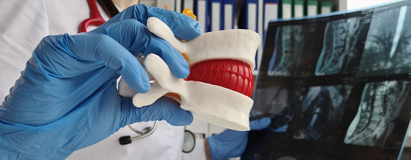 patient needing herniated disc chiropractor in Santa Rosa, CA